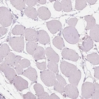 Immunohistochemical staining of human skeletal muscle shows no positivity in myocytes as expected.
