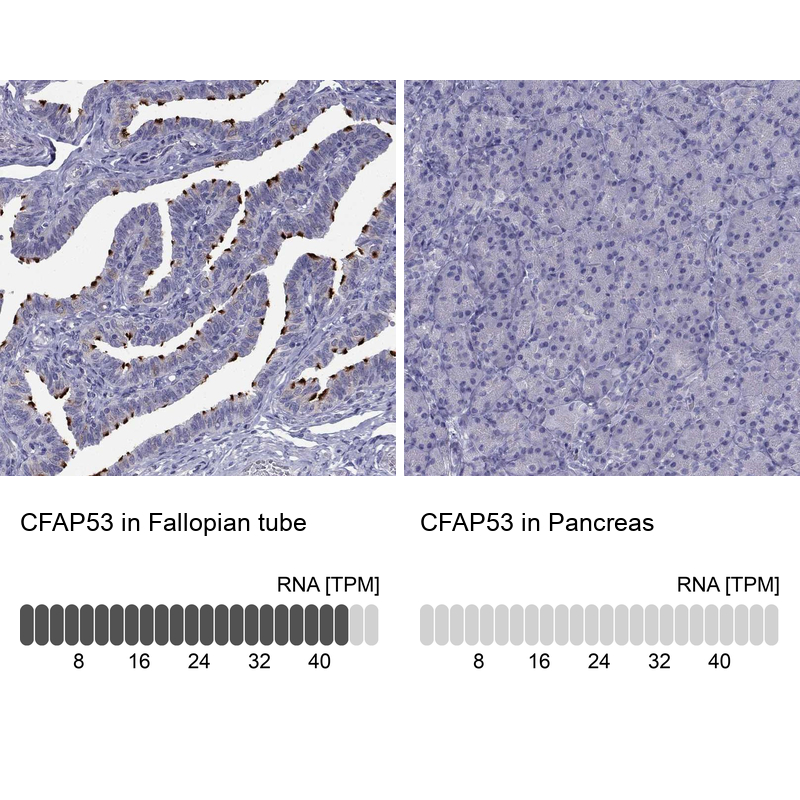 Anti-CFAP53 Antibody