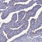 Immunohistochemical staining of human fallopian tube shows high expression.
