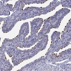 Immunohistochemical staining of human fallopian tube shows high expression.