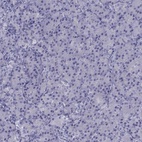 Immunohistochemical staining of human pancreas shows low expression as expected.