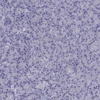 Immunohistochemical staining of human pancreas shows low expression as expected.