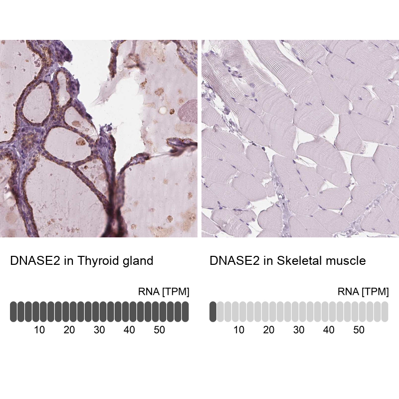 Anti-DNASE2 Antibody