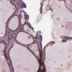 Immunohistochemical staining of human thyroid gland shows high expression.