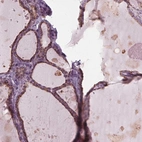 Immunohistochemical staining of human thyroid gland shows high expression.