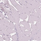 Immunohistochemical staining of human skeletal muscle shows low expression as expected.