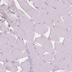 Immunohistochemical staining of human skeletal muscle shows low expression as expected.