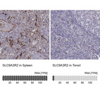 Anti-SLC9A3R2 Antibody