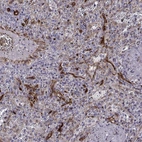 Immunohistochemical staining of human spleen shows high expression.