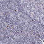 Anti-SLC9A3R2 Antibody