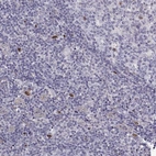 Immunohistochemical staining of human tonsil shows low expression as expected.
