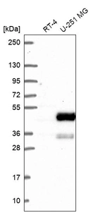 Western blot analysis in human cell line RT-4 and human cell line U-251 MG.