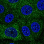 Anti-PABPC1L Antibody