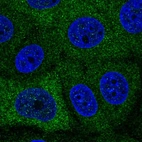 Anti-PABPC1L Antibody