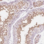 Anti-NUP210L Antibody