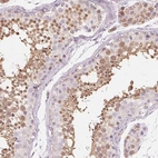 Anti-NUP210L Antibody