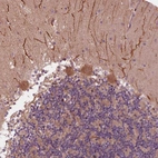 Immunohistochemical staining of human cerebellum shows strong cytoplasmic positivity in Purkinje cells.