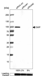 Western blot analysis in A-549 cells transfected with control siRNA, target specific siRNA probe #1 and #2, using Anti-CMIP antibody. Remaining relative intensity is presented. Loading control: Anti-GAPDH.