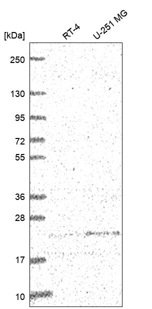 Anti-ULBP2 Antibody