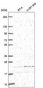Anti-ULBP2 Antibody