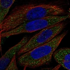 Immunofluorescent staining of human cell line SiHa shows localization to vesicles.
