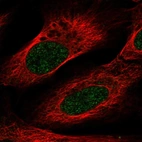 Anti-VSIG10L Antibody