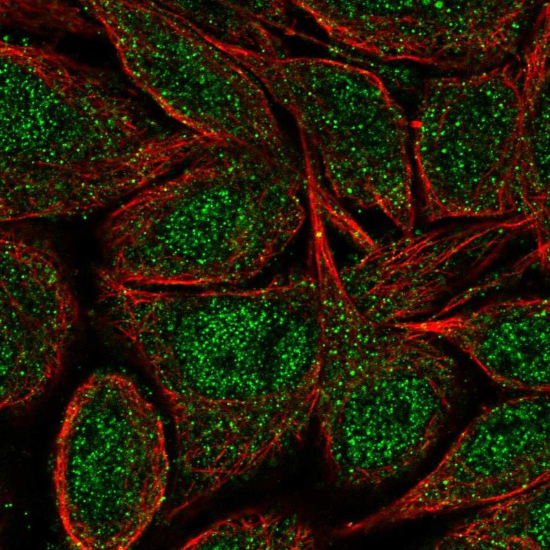 Anti-ZNF34 Antibody