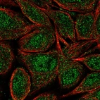 Anti-ZNF34 Antibody