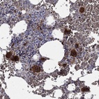 Anti-CTSW Antibody