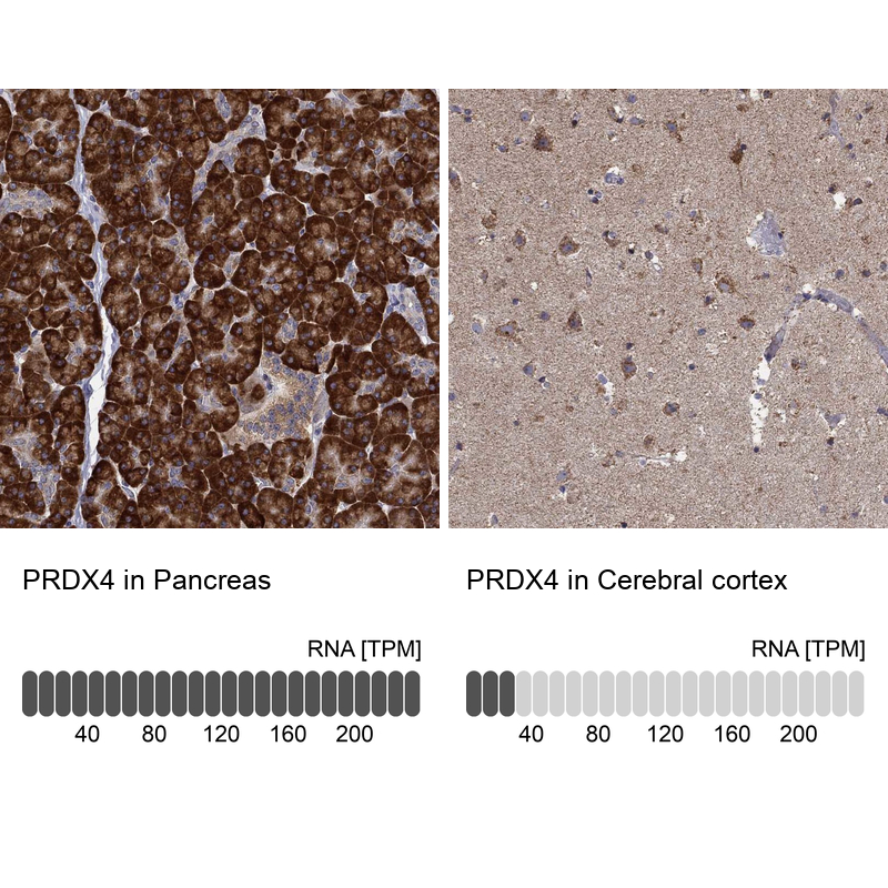 Anti-PRDX4 Antibody