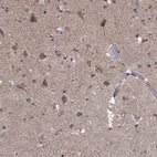 Immunohistochemical staining of human cerebral cortex shows low expression as expected.