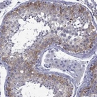 Anti-EPPIN-WFDC6 Antibody
