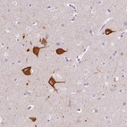 Anti-FAM163B Antibody