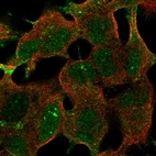 Immunofluorescent staining of human cell line SH-SY5Y shows localization to nuclear bodies, plasma membrane & cytosol.