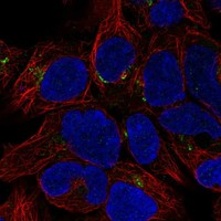 Anti-METTL26 Antibody