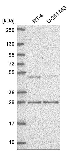 Anti-MBD2 Antibody