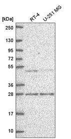 Anti-MBD2 Antibody