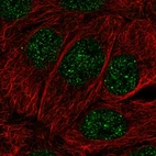 Immunofluorescent staining of human cell line HaCaT shows localization to nucleoplasm.