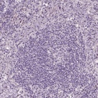 Immunohistochemical staining of human lymph node shows low expression as expected.