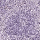 Immunohistochemical staining of human lymph node shows low expression as expected.