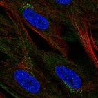 Immunofluorescent staining of human cell line BJ shows localization to cytosol & the Golgi apparatus.