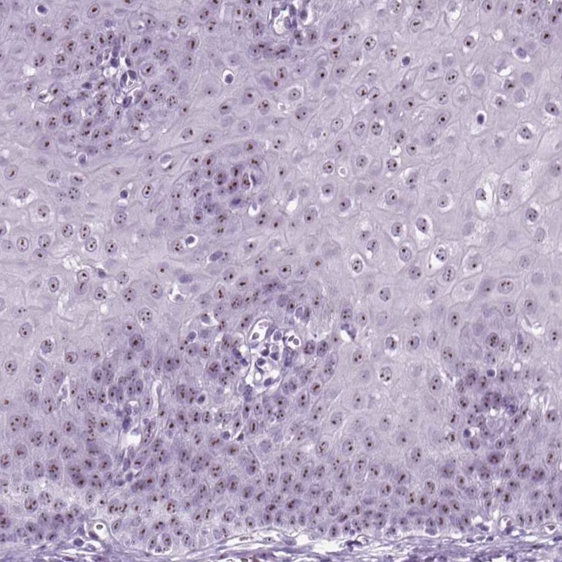 Anti-ZNF865 Antibody