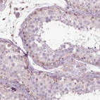 Anti-IL31RA Antibody