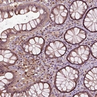 Immunohistochemical staining of human colon shows moderate cytoplasmic positivity in lymphoid cells and glandular cells.