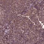 Immunohistochemical staining of human lymphoid tissues shows moderate cytoplasmic positivity in non-germinal center cells.