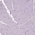 Immunohistochemical staining of human skeletal muscle shows no positivity in myocytes as expected.