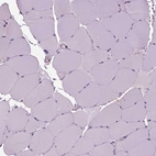 Immunohistochemical staining of human skeletal muscle shows no positivity in myocytes as expected.