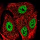 Immunofluorescent staining of human cell line A549 shows localization to nucleoplasm.