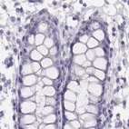 Immunohistochemical staining of human colon using Anti-HIST1H1T antibody HPA068266.