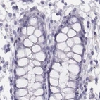 Immunohistochemical staining of human colon using Anti-HIST1H1T antibody HPA068266.